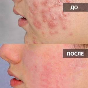 ������� ������ � �����������, ����� ������